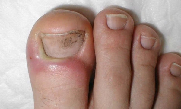 how-to-maintain-nails-healthy

